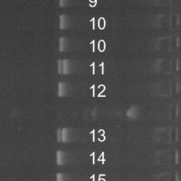 DNA-Kønstest
